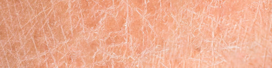 A ciência da recuperação dérmica: Por que a sua barreira cutânea exige nutrição lipídica?